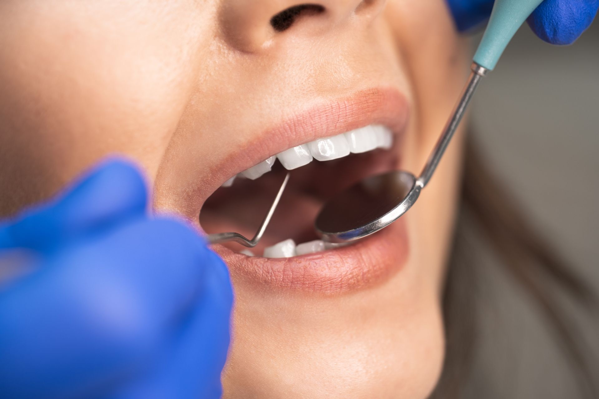 A dental professional inspecting a tooth for a root canal.