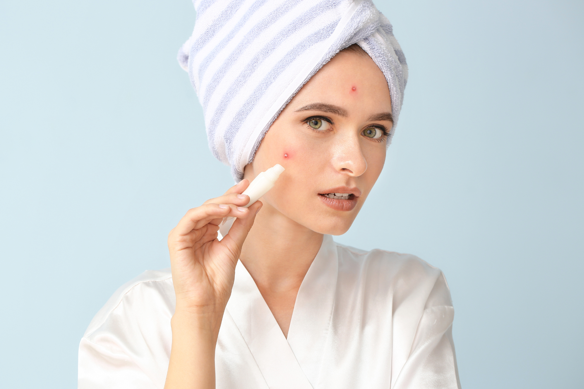 Over-the-Counter vs. Prescription Treatments for Acne