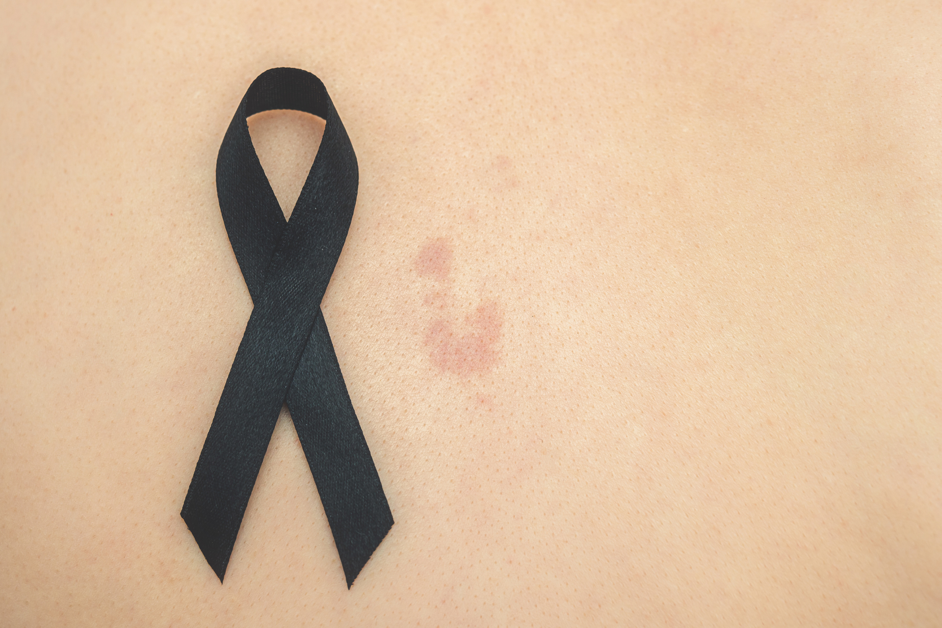 Skin Cancer Awareness