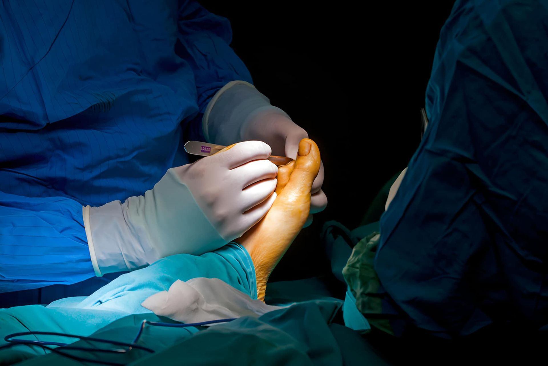 A Surgeon Is Operating On A Patient's Foot In An Operating Room — Hastings Podiatry Centre In Port Macquarie, NSW
