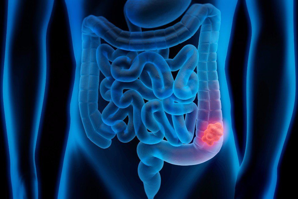 Fecal Incontinence at Digestive Diseases Center