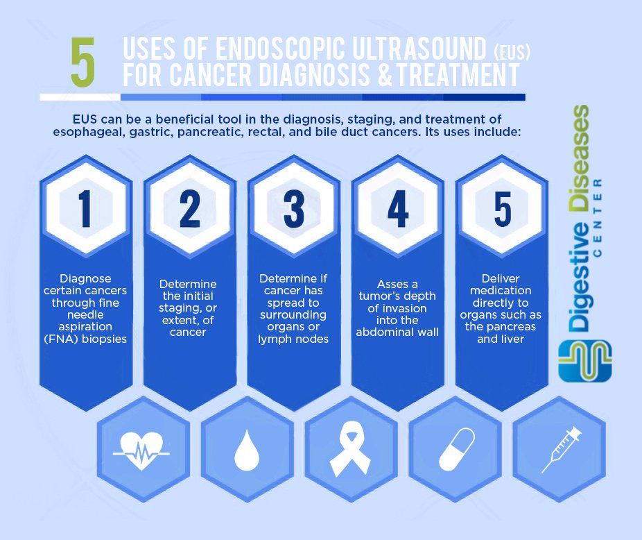 5 Uses of Endoscopic Ultrasound (EUS) for Cancer Diagnosis & Treatment [Infographic]