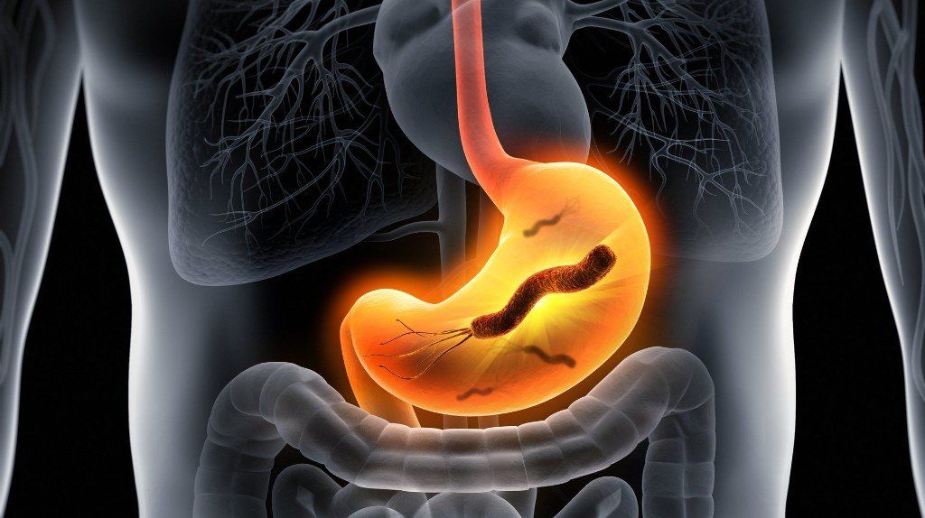 H. Pylori Infections: Transmission, Symptoms, and Treatment