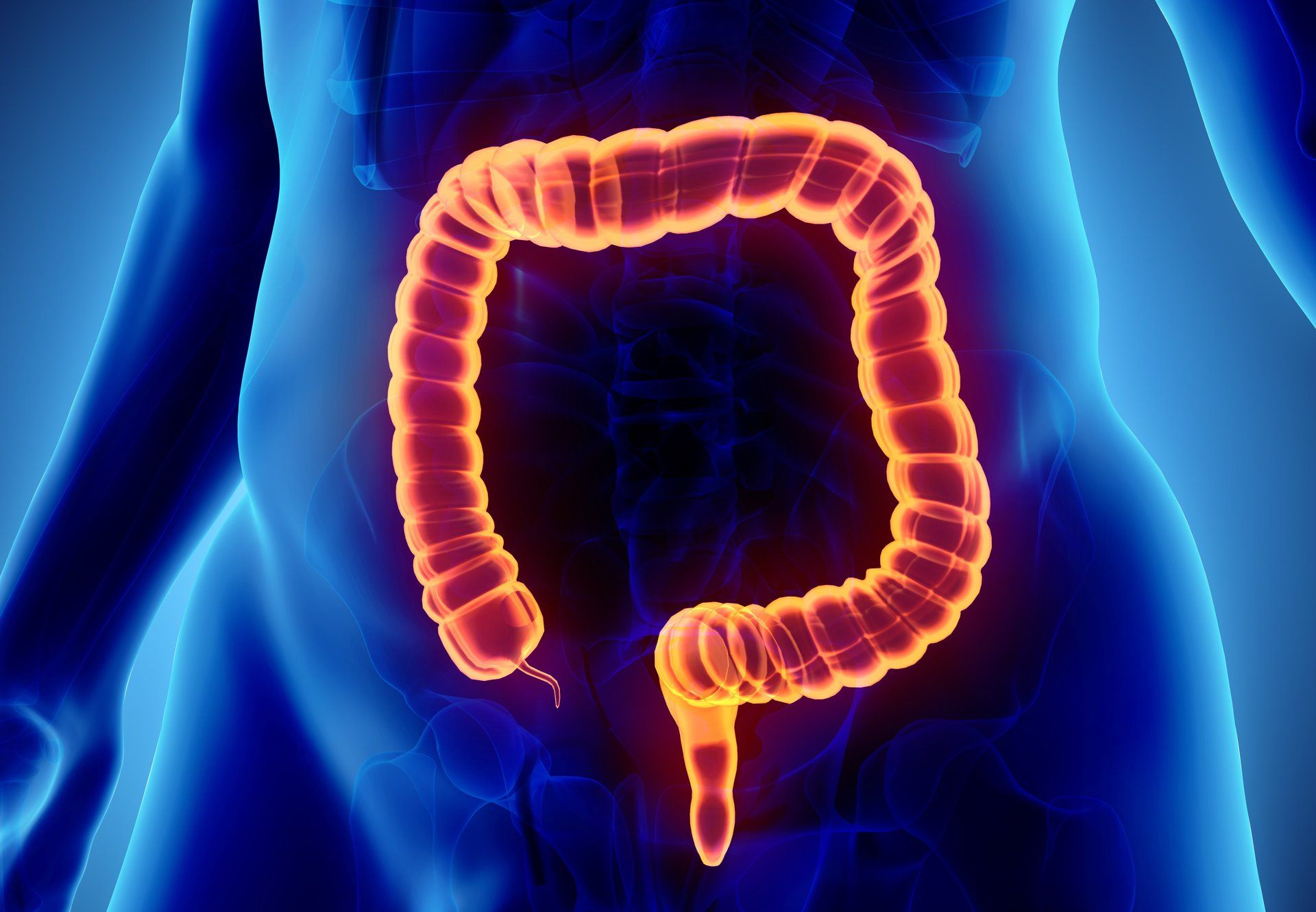 Irritable Bowel Syndrome at Digestive Disease Center