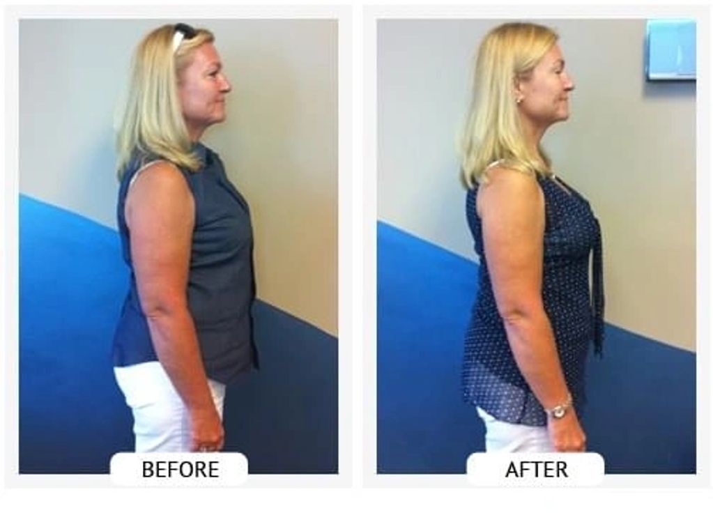 Before and After- Jeanie lost 20 lbs and 20 inches in 42 days.