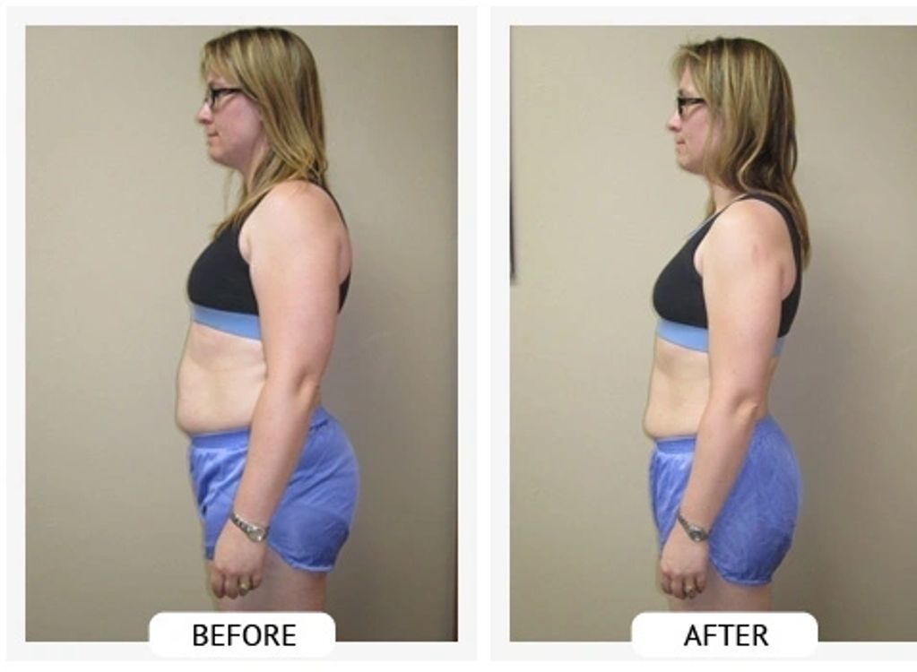 Before and After- Kristen lost 32 lbs and 24.5 lbs in 42 days.