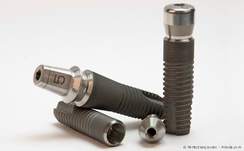 Die meisten der heute verwendeten Implantate bestehen aus dem Metall Titan. Es gibt aber auch Implantate aus Keramik. Die meisten der heute verwendeten Implantate bestehen aus dem Metall Titan. Es gibt aber auch Implantate aus Keramik.