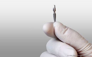 Mini-Implantat für schonende Behandlung Mini-Implantat für schonende Behandlung