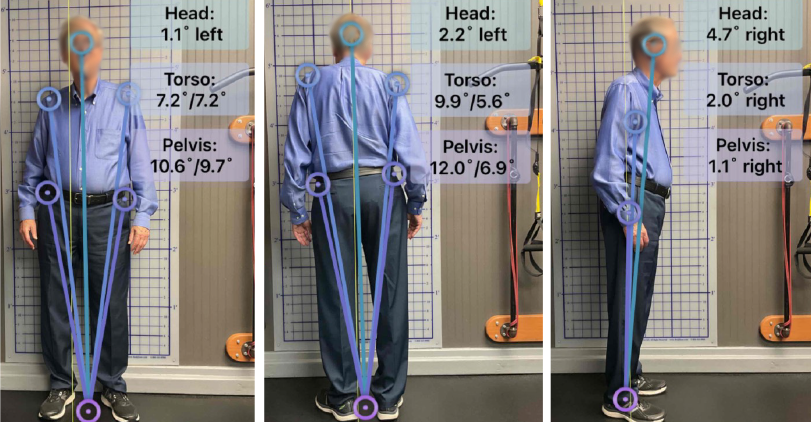 Balance and posture training - Warren NJ - body basics fit