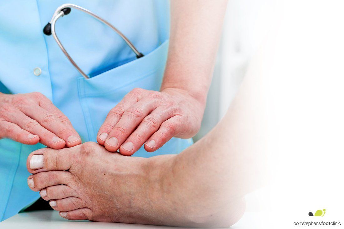 Podiatry Services In Lambton, Newcastle, Hunter Valley | Port Stephens ...