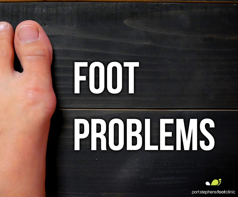 Newcastle Podiatry foot problems
