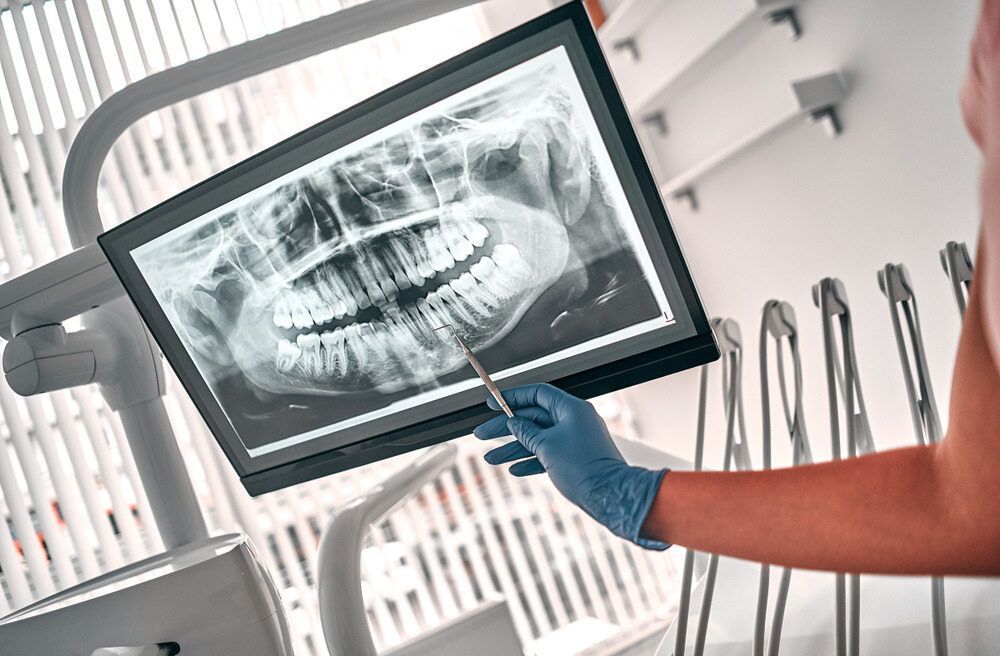 A dentist is looking at an x-ray of a patient 's teeth on a computer screen — Barry Bennett Dental In Earlville, QLD