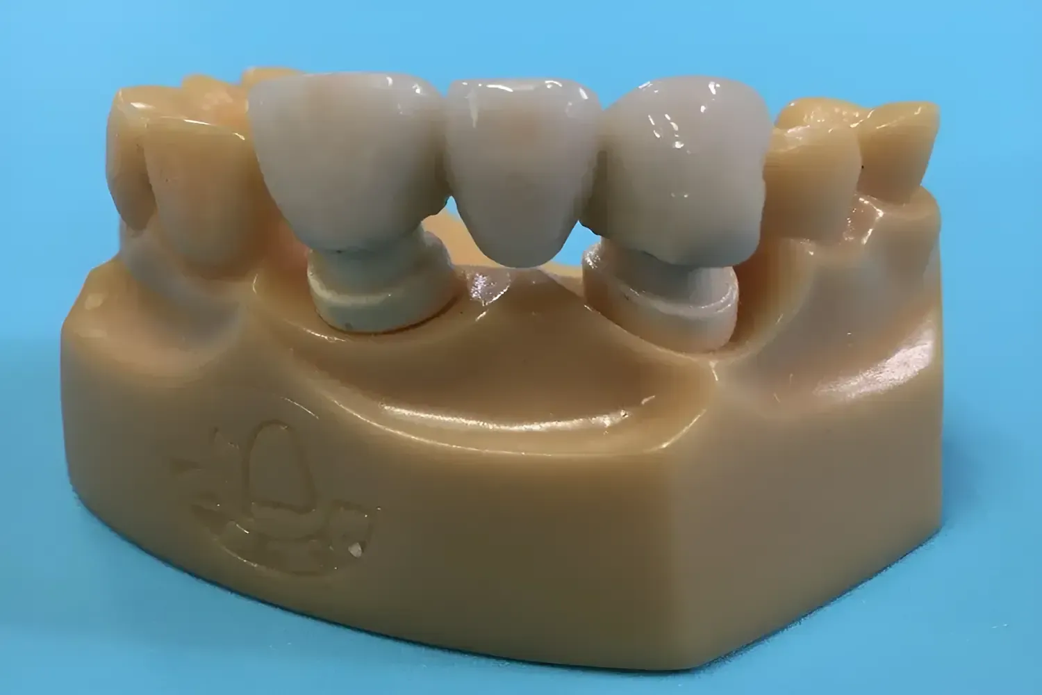 A Dentist Is Working On A Patient 's Teeth With A Light — Barry Bennett Dental In Earlville, QLD