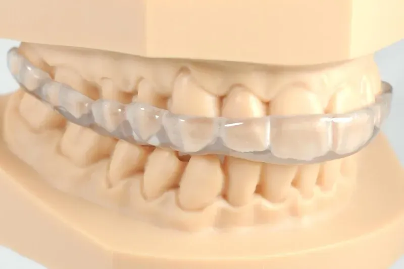 Clear plastic dental retainer on a model of teeth.