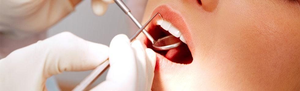 Igiene dentale Palma