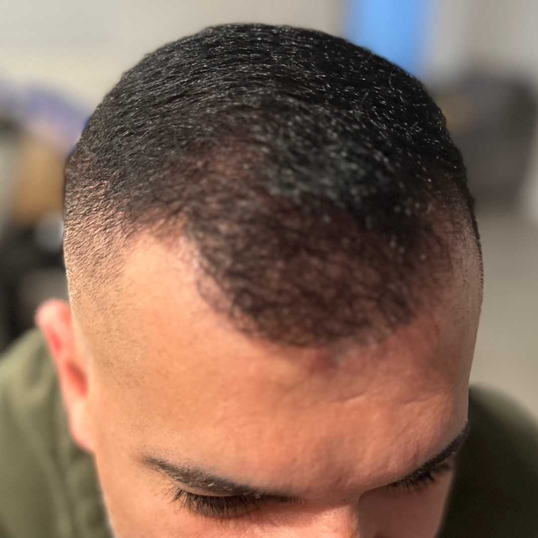Man's head with dark, wavy hair, faded sides, and visible scalp near hairline, indoors.