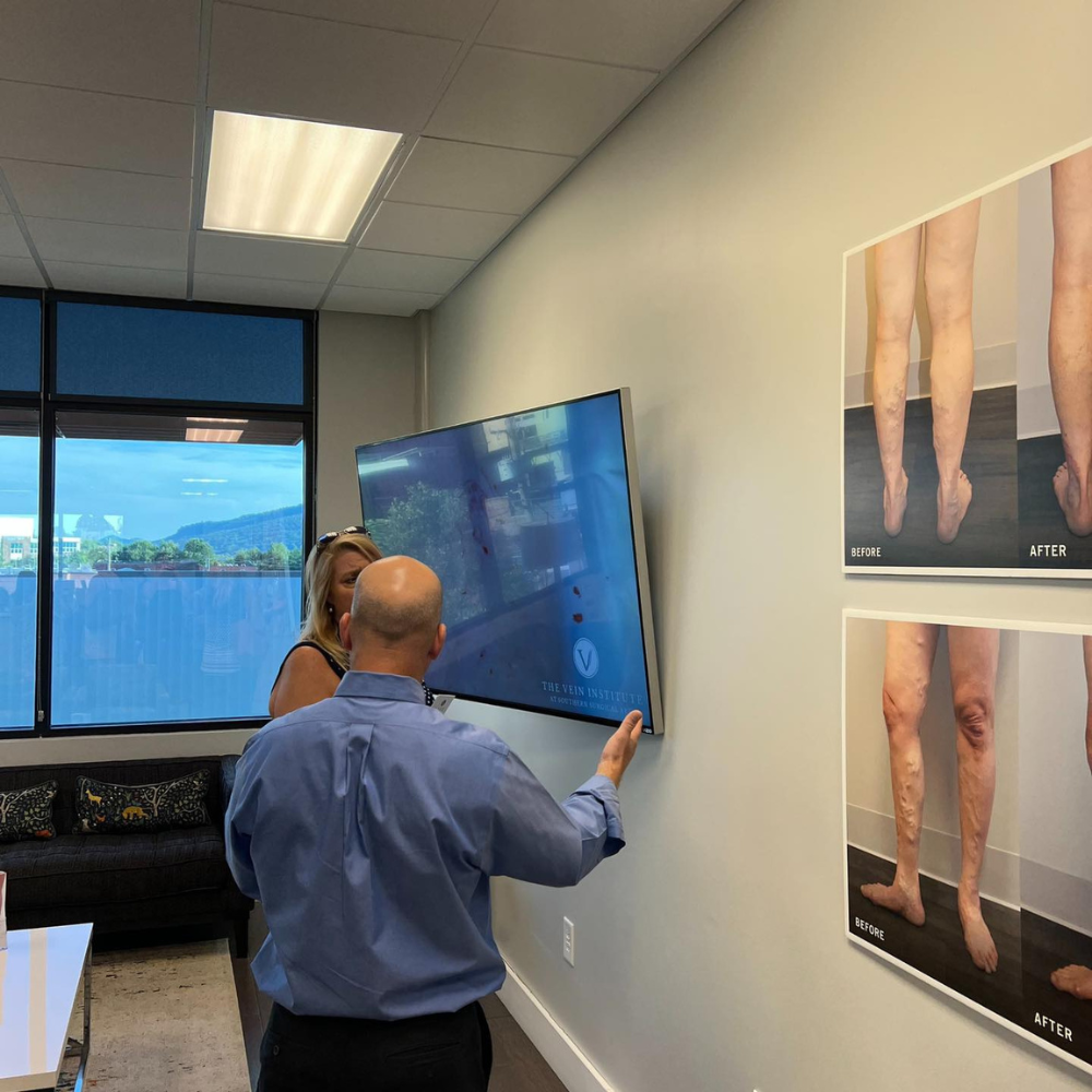 A man is pointing at a screen in a room with pictures of legs on the wall