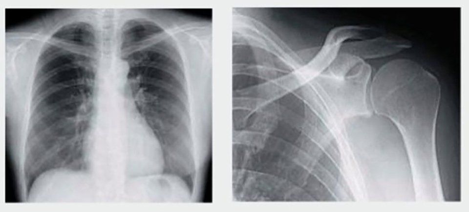 radiografia paziente