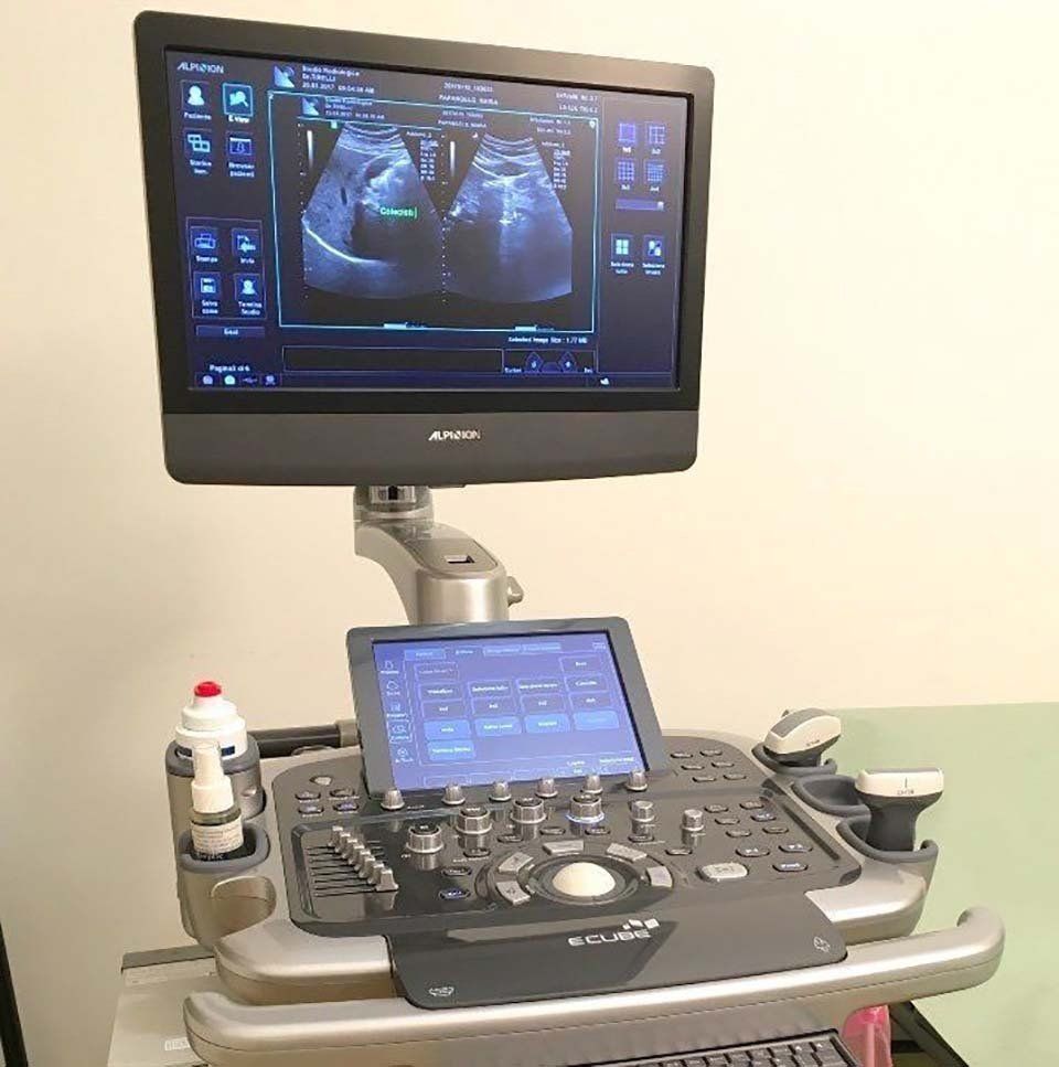 monitor per ecografia