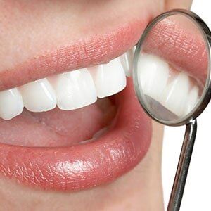 Woman Smiling with Dental Mirror - Dentist in Carneys Point, NJ