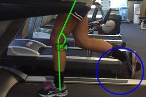 Patient Running On The Treadmill — Murrysville, PA — Alliance Physical Therapy