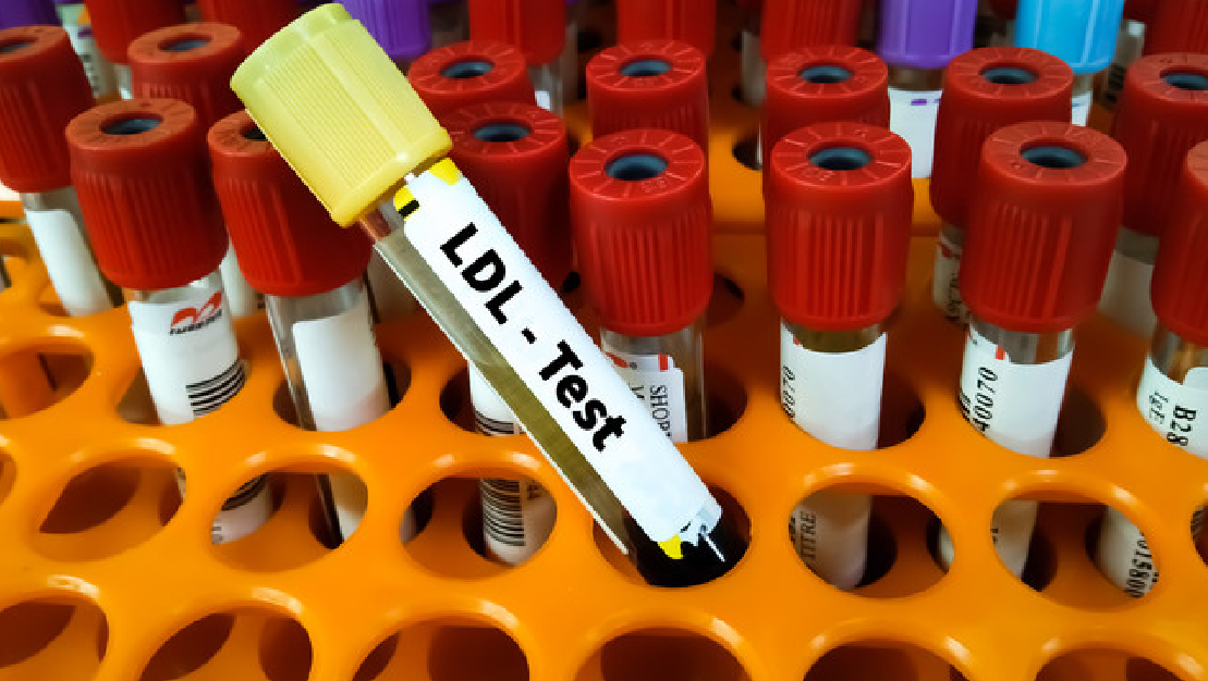 A test tube with ldl test written on it