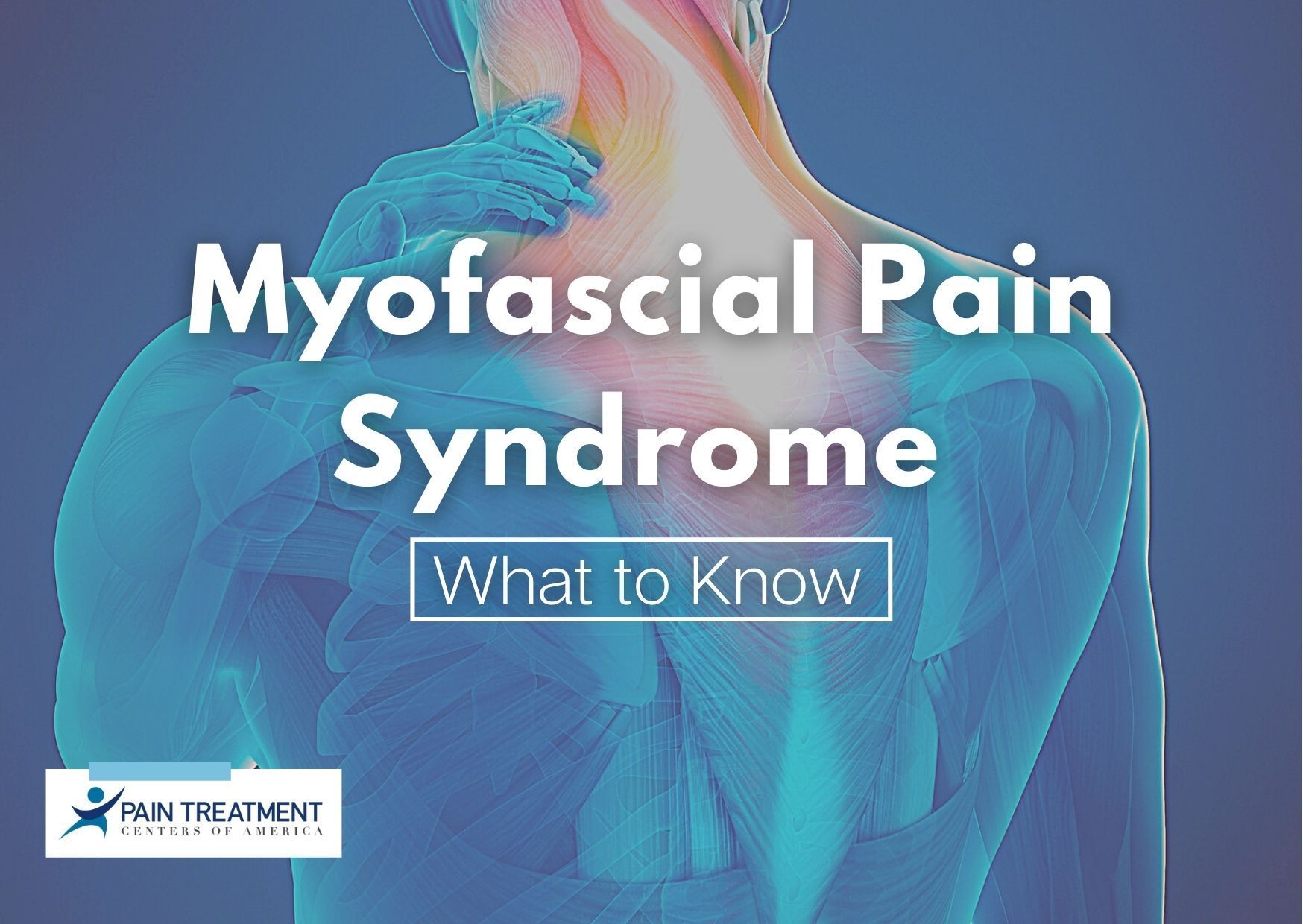 What To Know About Myofascial Pain Syndrome