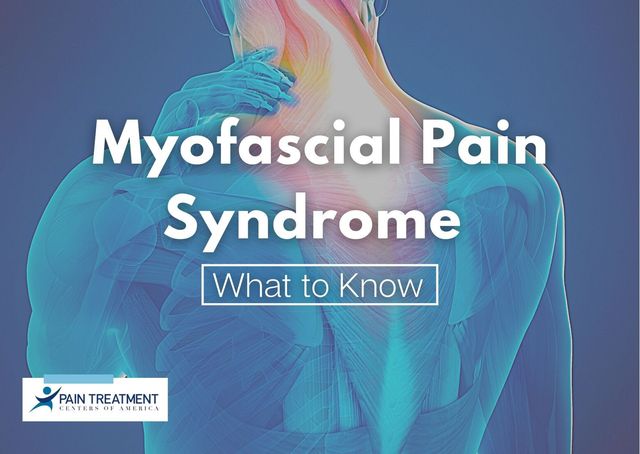 What To Know About Myofascial Pain Syndrome