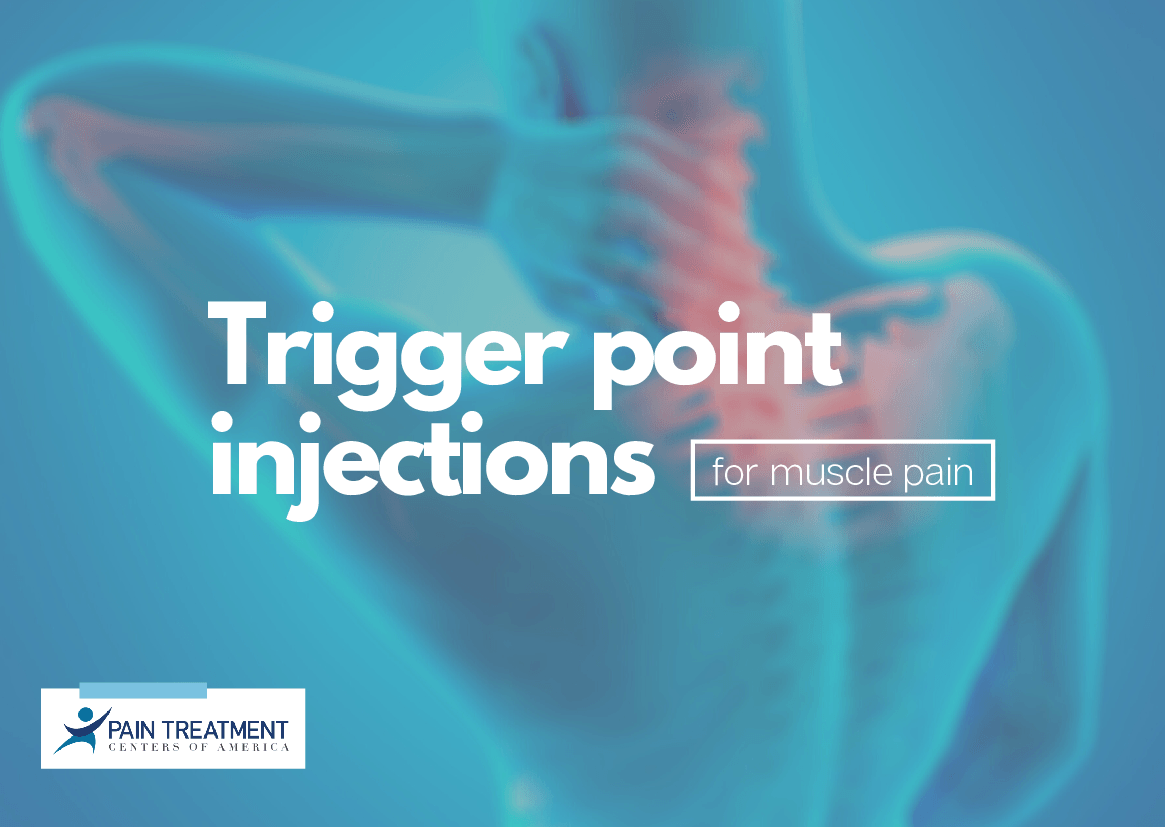 Trigger Point Injections Graphic