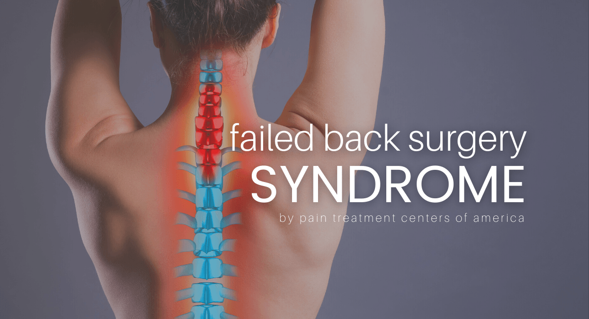 Failed back surgery syndrome blog graphic