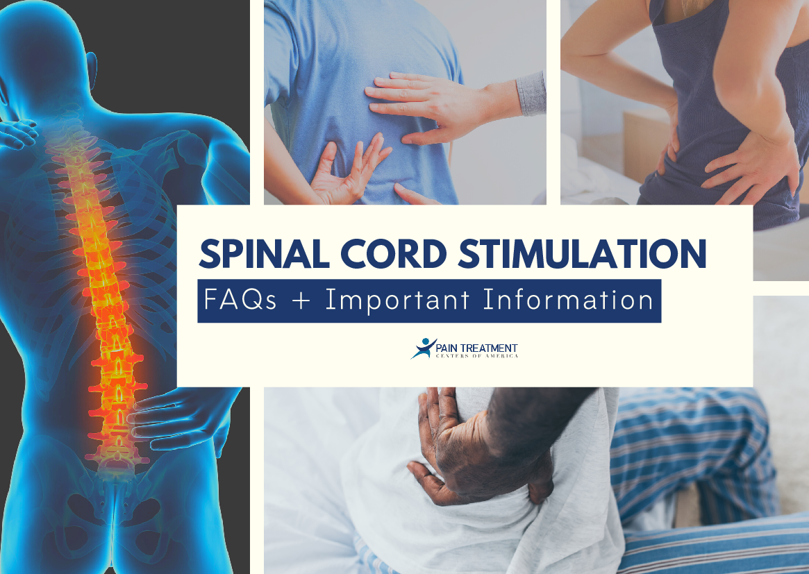 Spinal Cord Stimulator FAQs PTCOA