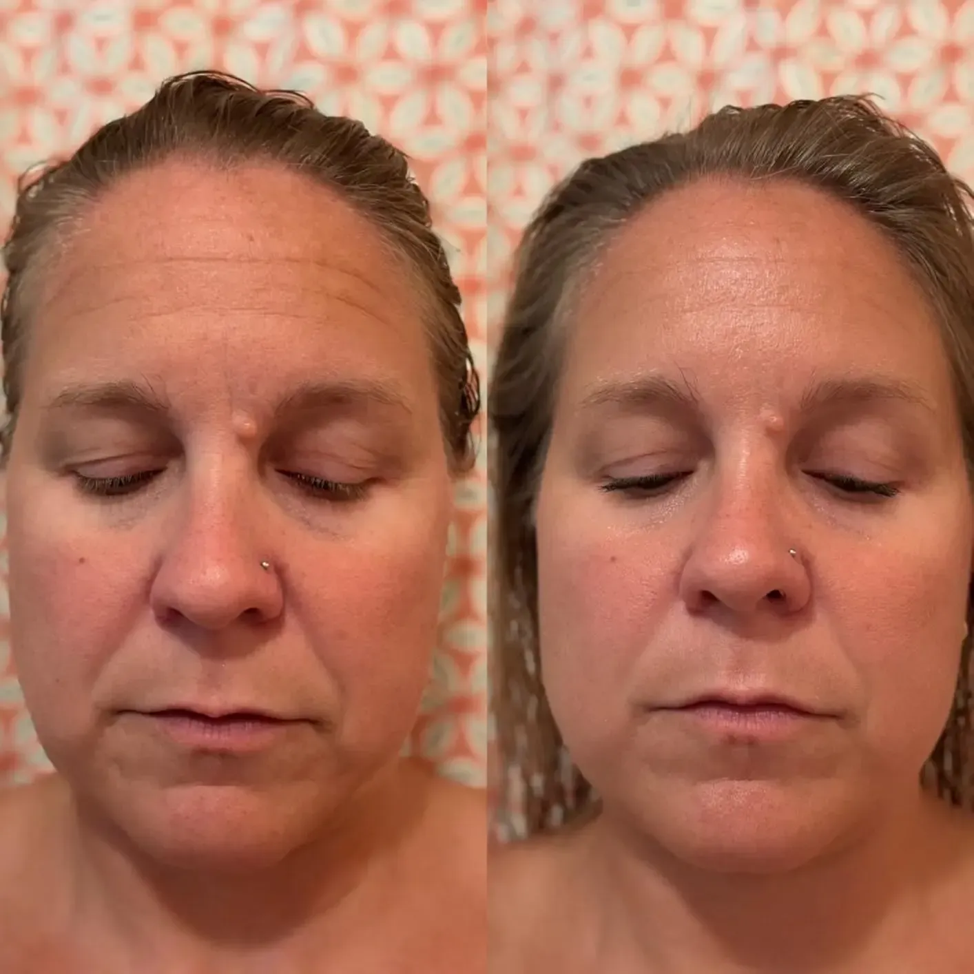 before and after image showing skin before using lumenvy skincare products