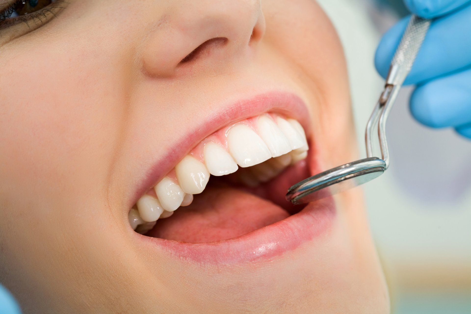 Dental Fillings – Cape Girardeau, MO – Harter Family Dental