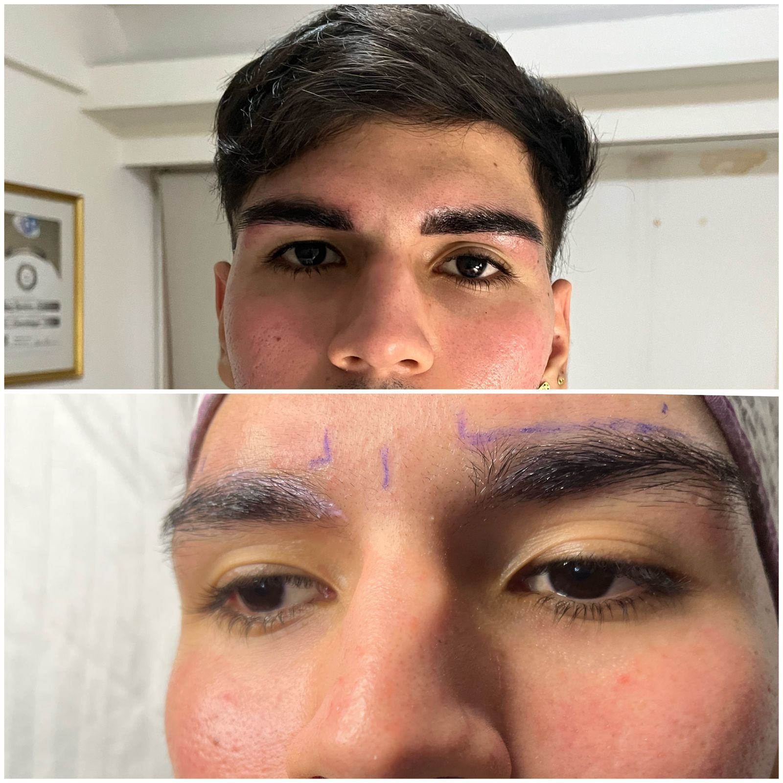 Dos imágenes del rostro de una persona. 