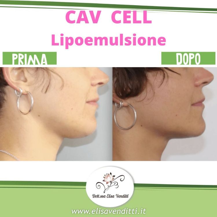 Lipoemulsione viso