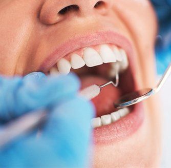Open female mouth during oral checkup at the dentist — Orthodontics Dentists in York, PA