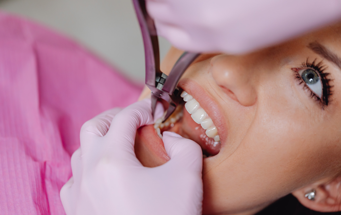 A dentist in pink gloves uses dental tools to work on a patient's upper teeth.
