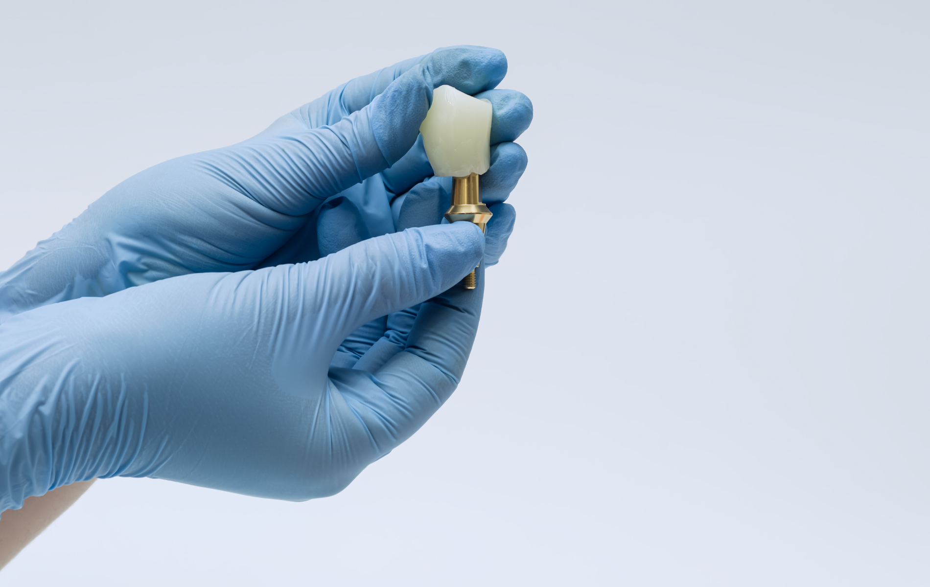 A gloved hand holds a dental implant and crown against a plain, light-colored background.