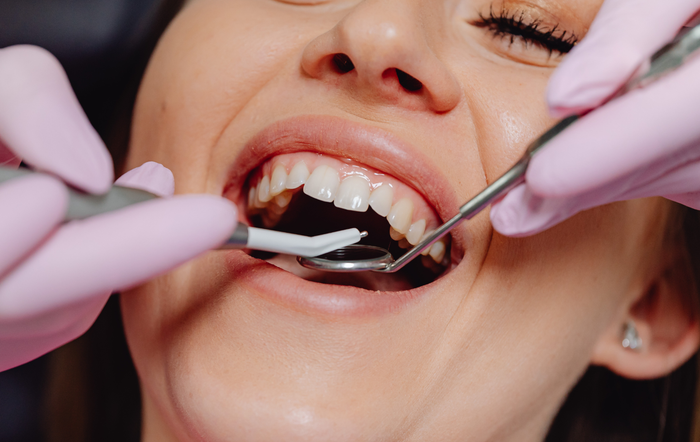 A dental professional in light pink gloves uses a mirror and tool to examine a patient's teeth in a clinical setting.