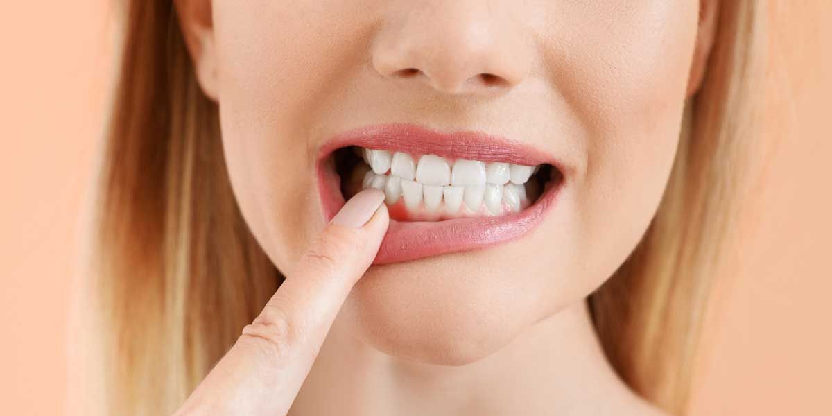 A person pointing to a localized area of red, inflamed gum tissue near their lower front teeth.