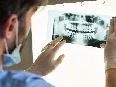 radiografia dentistica