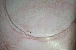 Dye penetrant testing