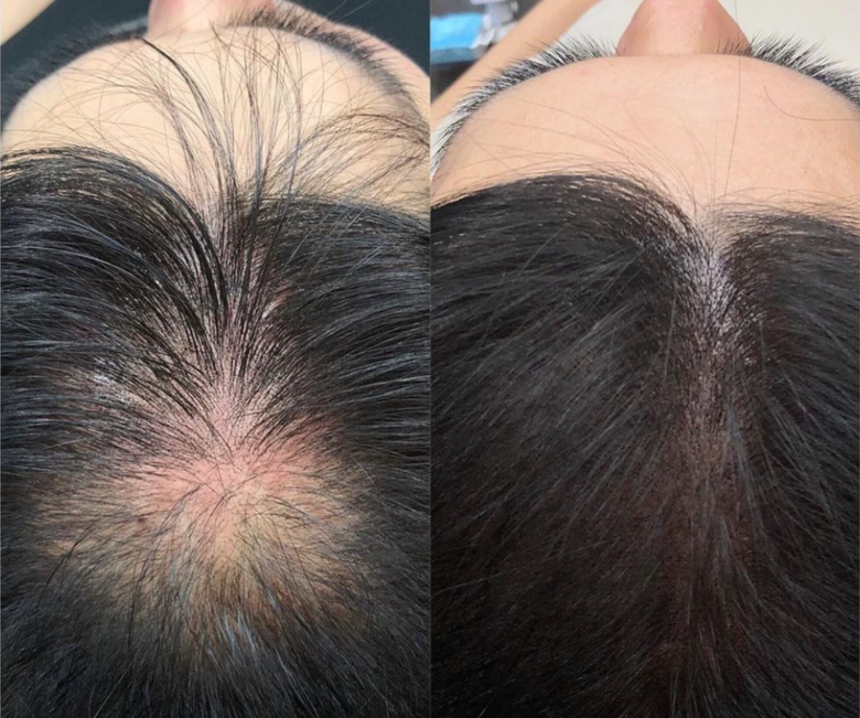 A before and after picture of a person 's hair