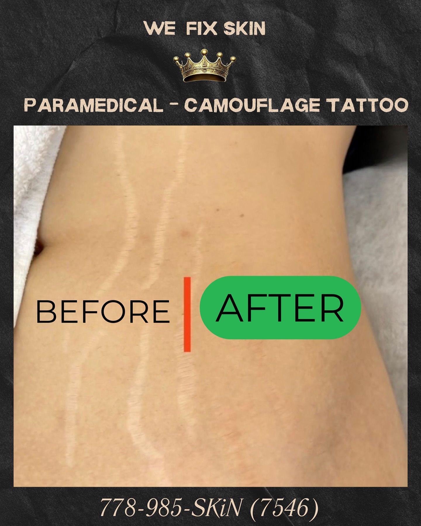 Camouflage Tattoo Results