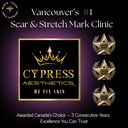 A logo for cypress aesthetics with a gold crown