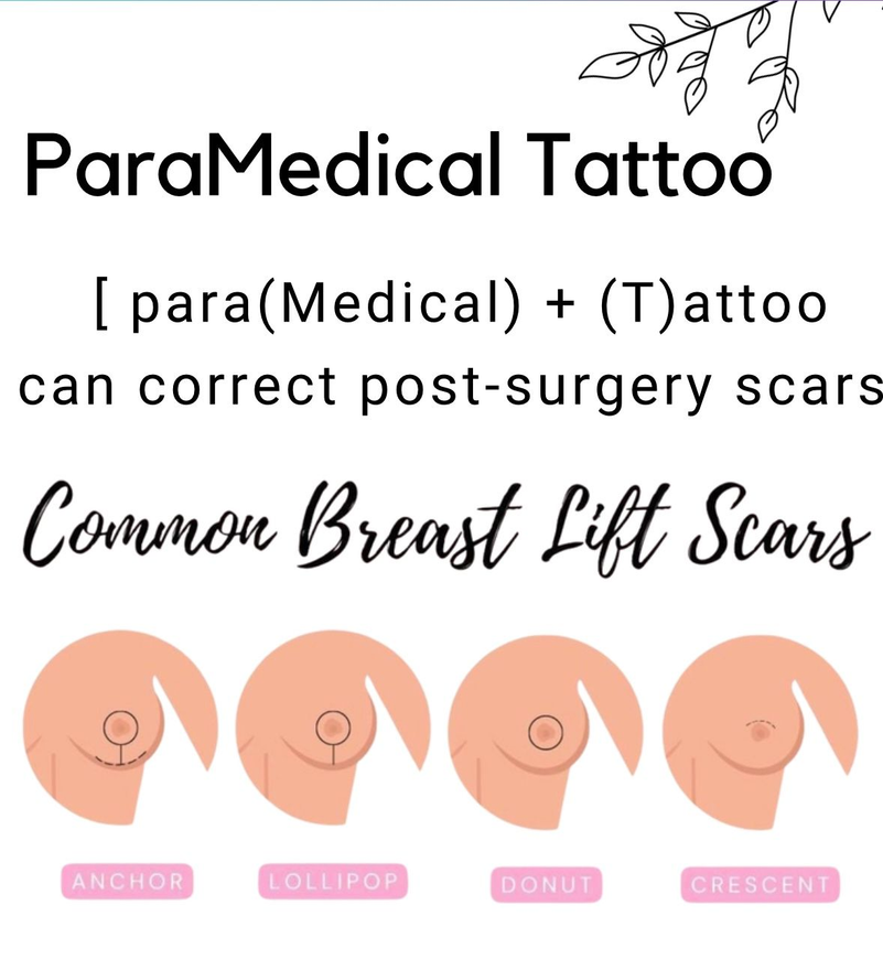 Paramedical camouflage tattoo specialists in Vancouver at cypress aesthetics 
