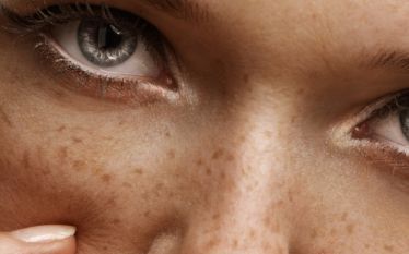 A close up of a woman 's face with freckles.