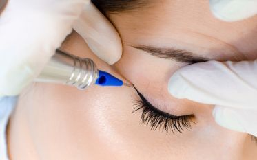 A woman is getting a permanent eyeliner tattoo on her eye.
