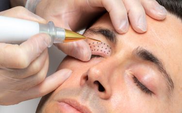 A man is getting a laser treatment on his eye.
