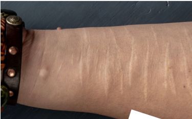 A close up of a person 's arm with a bracelet on it